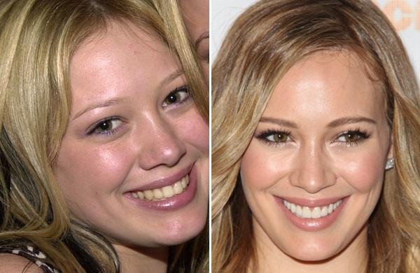 axn-stars-dentist-600-11