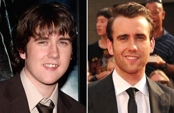 axn-stars-dentist-600-15