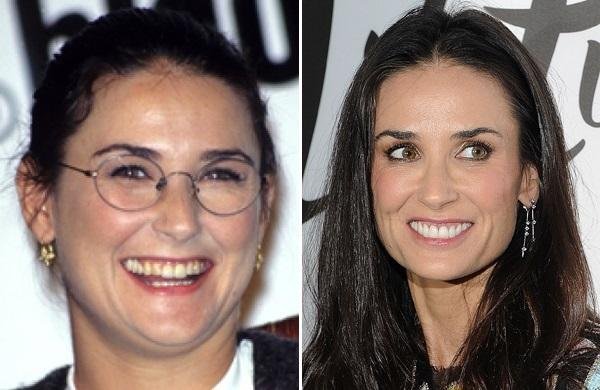 axn-stars-dentist-600-3